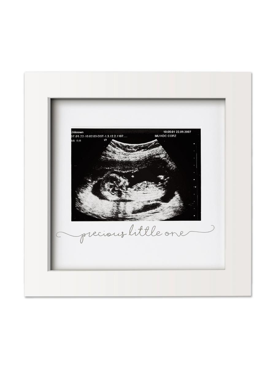 Sonogram Picture Frame